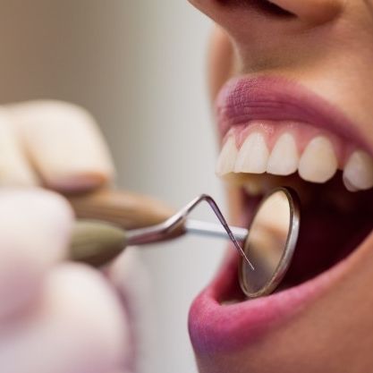 Consultas regulares ao dentista podem gerar economia